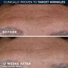 RoC Deep Wrinkle Serum, 1 Ounce