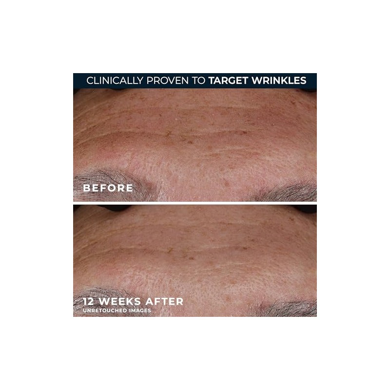 RoC Deep Wrinkle Serum, 1 Ounce