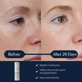Elemis Pro-Collagen Dynamic Resurfacing Super-C Serum, 30 ml