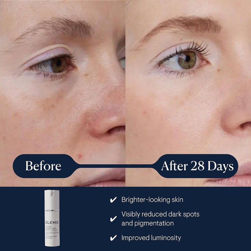 Elemis Pro-Collagen Dynamic Resurfacing Super-C Serum, 30 ml