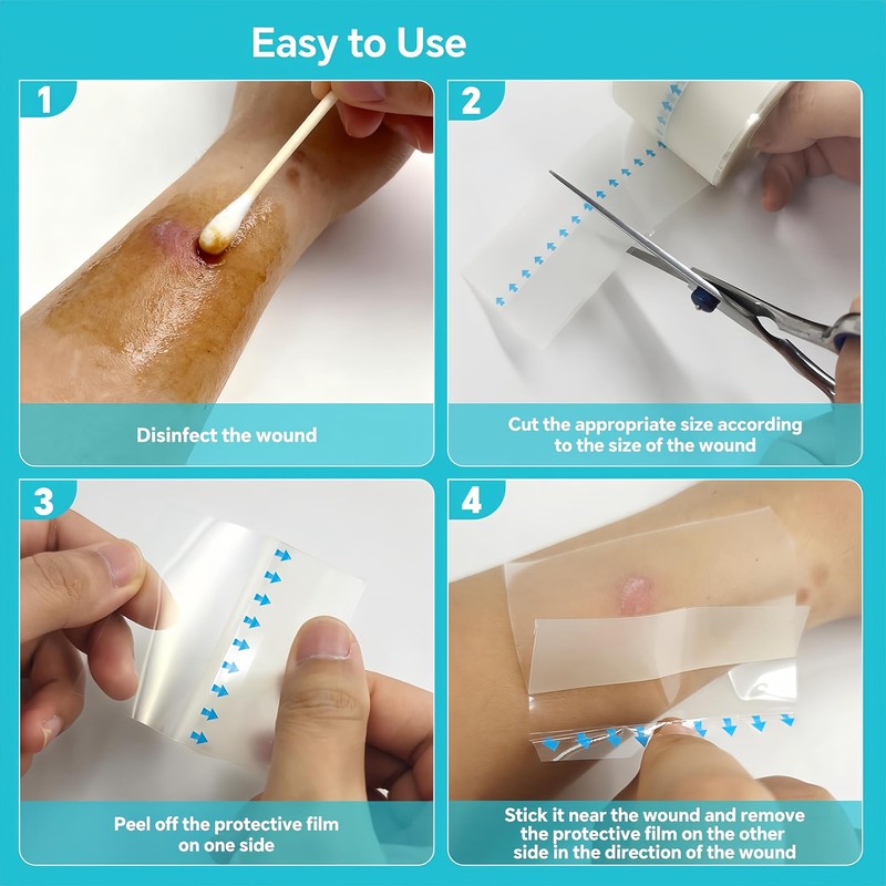 Hydrocolloid Dressing Roll, 2 in x 16.4 ft, Waterproof, Cut