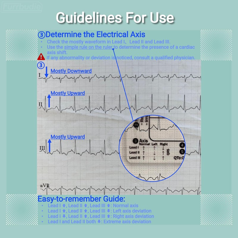 ECG 7 Step Ruler 2pcs ECG Ruler Plastic Ruler Measuring