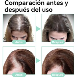 Aceite De Romero：Aceite de Romero para El Cabello-100%, Aceite Esencial de Romero para Cabello ，Estimula el Crecimiento del Cabello, Ideal para Cejas, Pestañas, Barba y Cabello Seco y Dañado.（60ml）