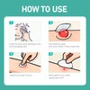 ANGTICS Pimple Patches Microdart, Zit Patches with Microdart Technology