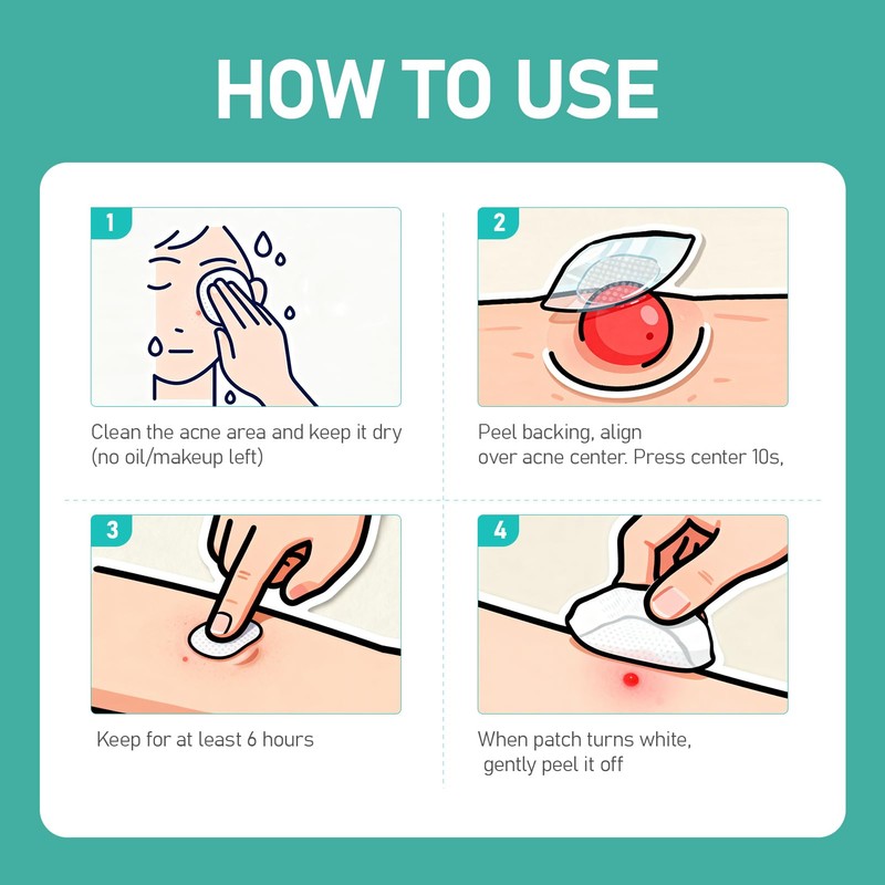 ANGTICS Pimple Patches Microdart, Zit Patches with Microdart Technology