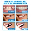Temporary Tooth Filling Kit,Temporary Tooth Repair Kits,Moldable False Teeth Replacement,False