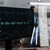 EKG Caliper and Ruler Combination Set, Electrocardiogram Divider for Nursing,