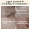 Crema Facial , Crema Removedora De Arrugas Qinglin Pa