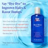 Tend Skin The Skin Care Solution For Unsightly Razor Bumps,