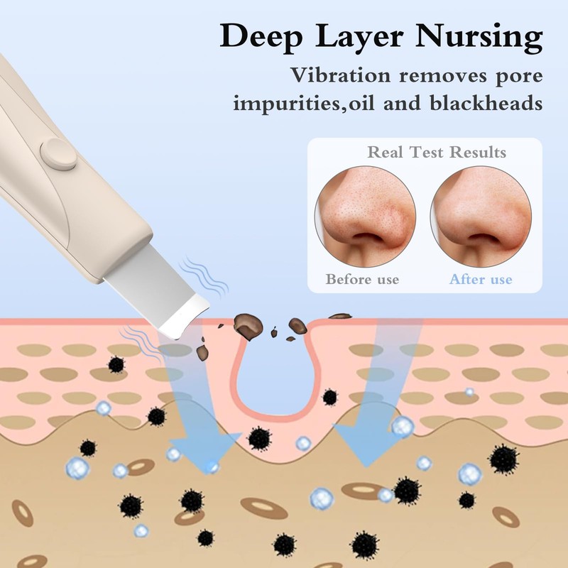 Skin Scrubber Face Spatula Skin Spatula Pore Cleaner Blackhead Remover