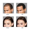 IMMETEE Hair Building Growth Fiber Kit Unisex Hair Thickener Denser