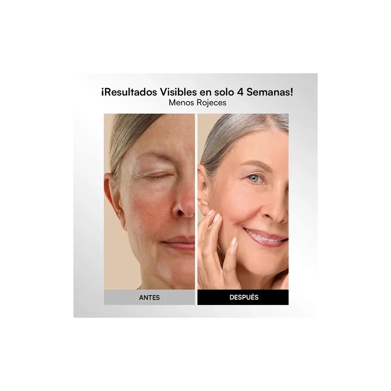 Inia Máscara Led Facial Para El Rostro De 4 Modos