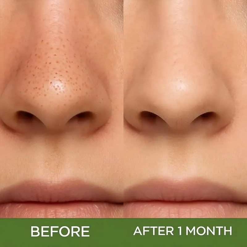 🔥 Mascarilla de arcilla para cara holy basil bubble deep