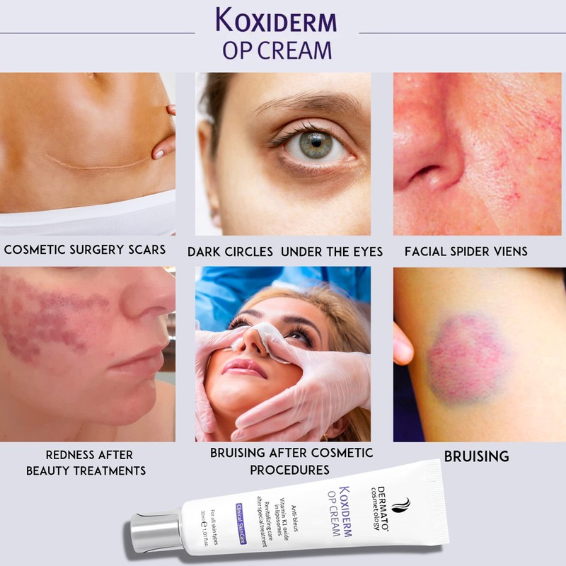 Vitamin K1 Oxiderm Cream, Minimizing Appearance of Scars, Dark Eye