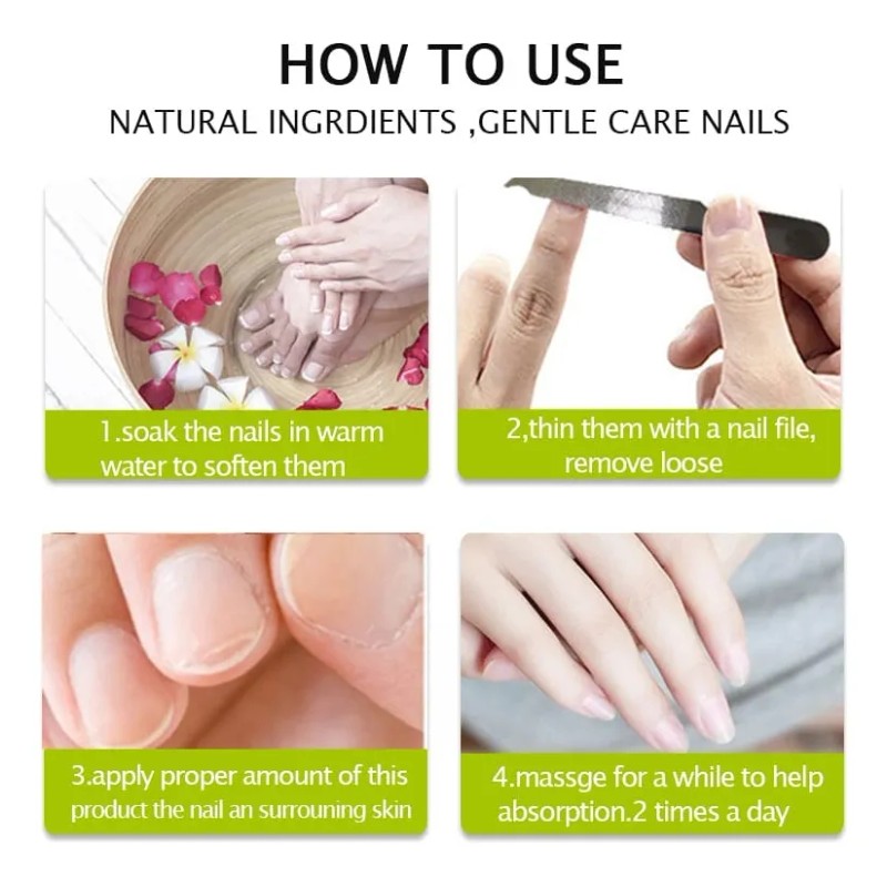 Gel Antihongo Tratamiento Reparador De Uñas Efero 2 Piezas