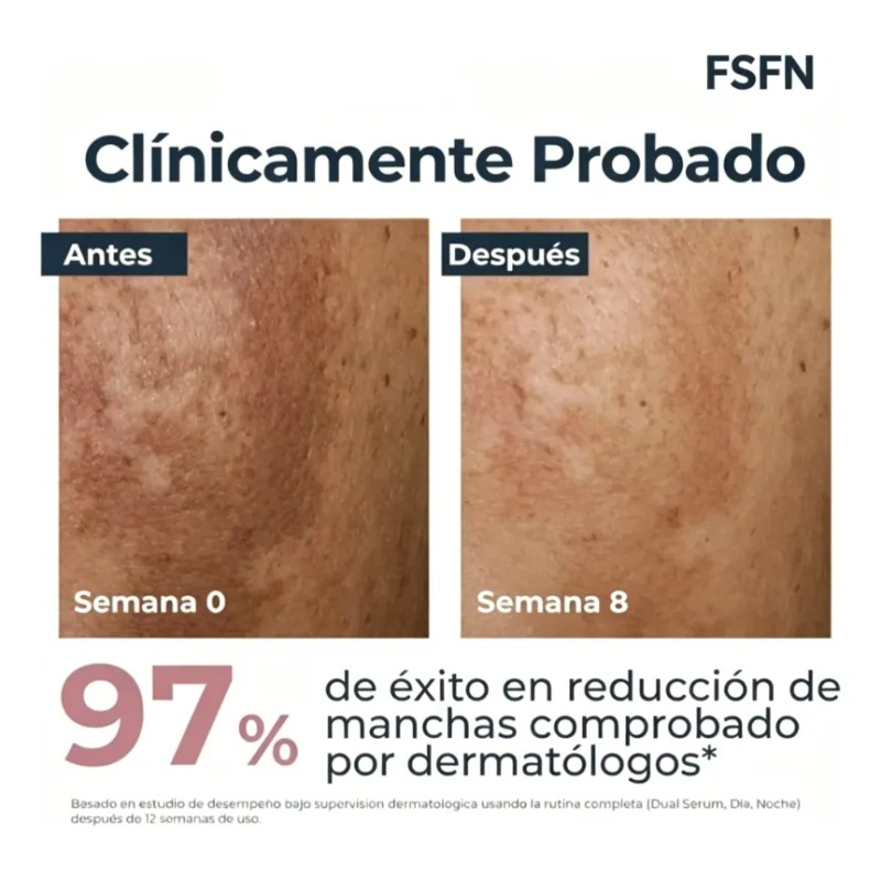 Sérum Facial Antimanchas Fsfn Antipigmentario Dual 30 Ml
