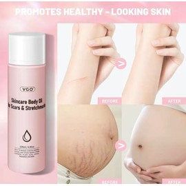 VGO-Skincare Body Oil for Scars &StretchmarksFade Scars and Stretch Marks, Proven BellyFirming Cream for Stretch Marks and Loose Skinskin oil - Volume: Skincare body oil 120ml