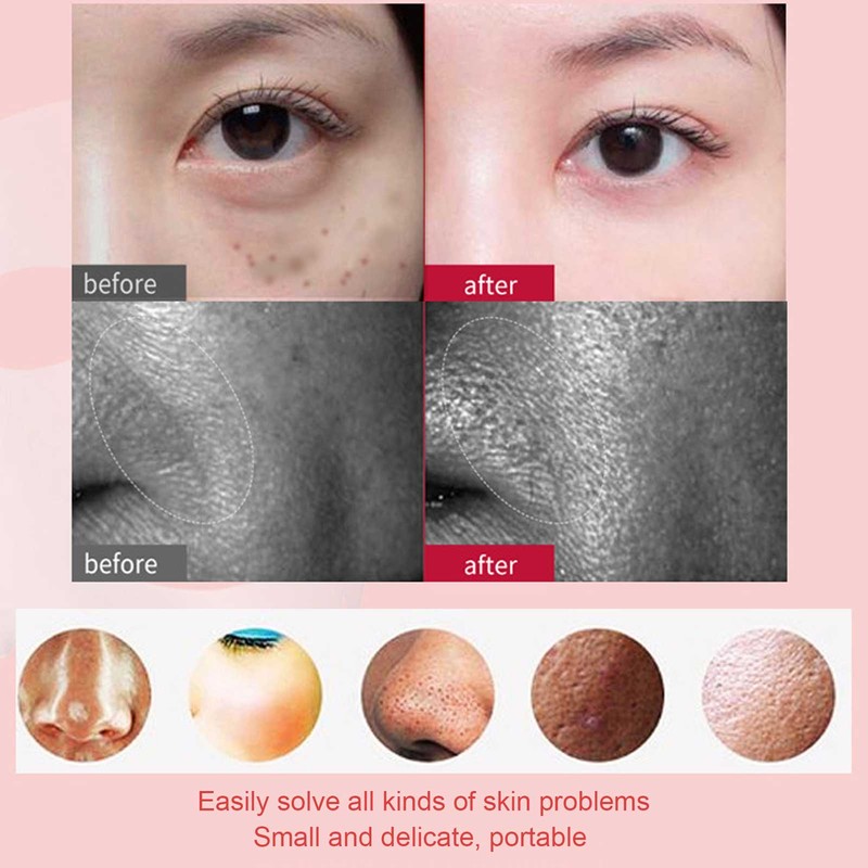 EMS Face Machine Househod Face Serum Imports Skin Rejuvenation Face