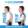 Back Support Brace Posture Corrector Traction Device - Relieves Neck,