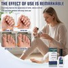 Nail Hardener Extra Strong, Hyaluronic Acid Nail Care Hardener Nail