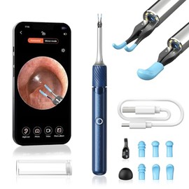 Qimic Ear Wax Removal Camera - Qimic 3-in-1 Ear Cleaner Earwax Removal Kit with Ear Pick & Tweezers, 8MP Wireless Otoscope with Light, 6 Pcs Ear Camera for Whole Family