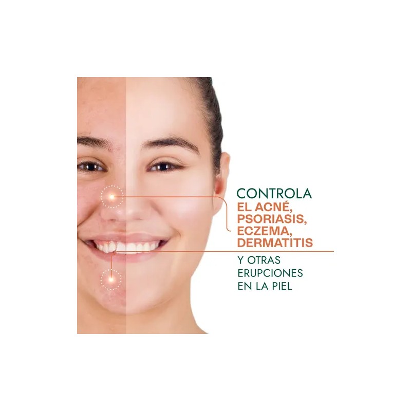Aceite de Caléndula Hebbe Cosmetics para Piel Seca y Sensible
