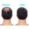3D Hair Loss Fibres for Thinning Hair 35g (Medium Brown)