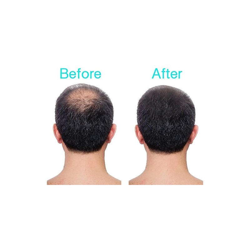 3D Hair Loss Fibres for Thinning Hair 35g (Medium Brown)