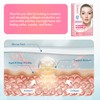 Rossy Forehead Wrinkle Patches: Forehead Wrinkles Treatment - Anti Wrinkle