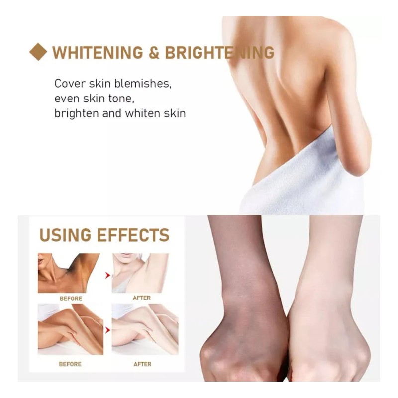 - 3*crema Blanqueadora Piel, Crema Aclaradora For Íntimos