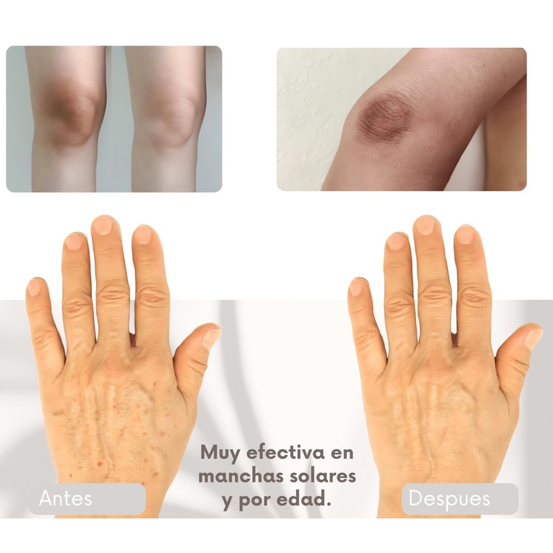 Clear Tone Crema Despigmentante 50g - Manchas Solares, Edad y