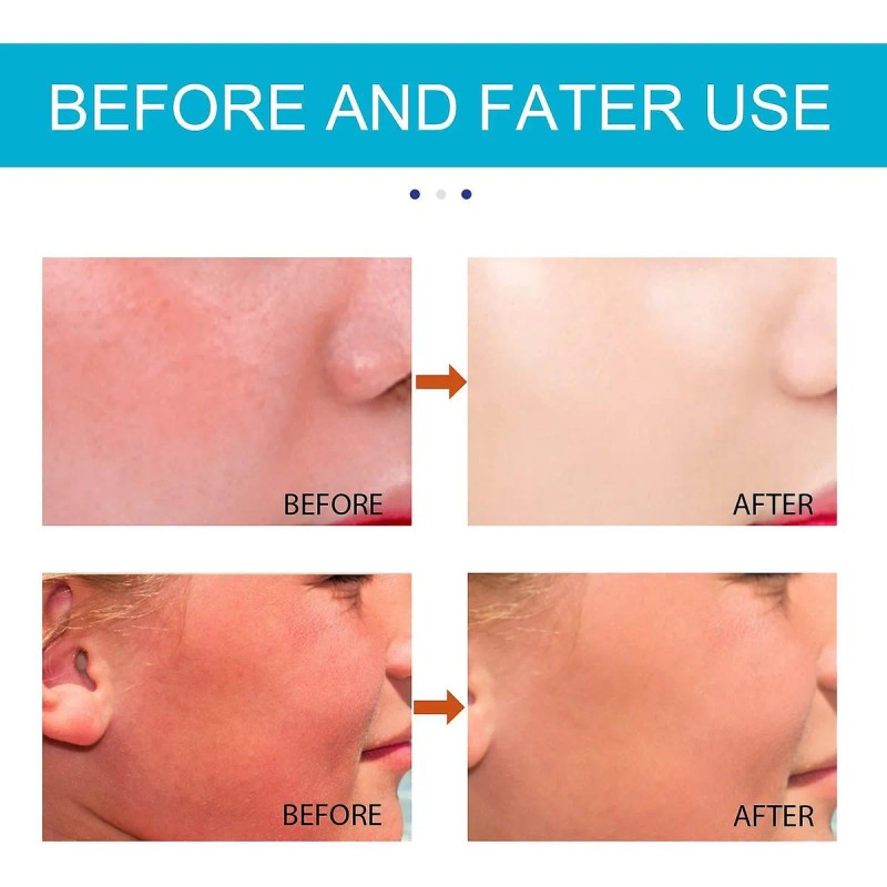 Protector Solar Facial Barra Jaysuing 20gr Spf50 Hidratante