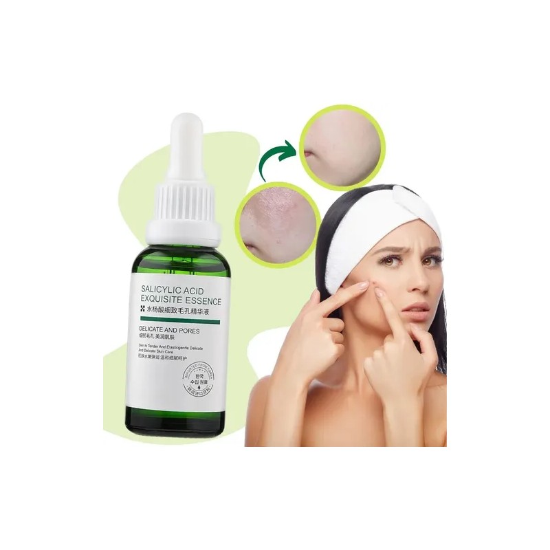 Liquido Antiacne Serum Reparador Espinillas Acido Salicilico