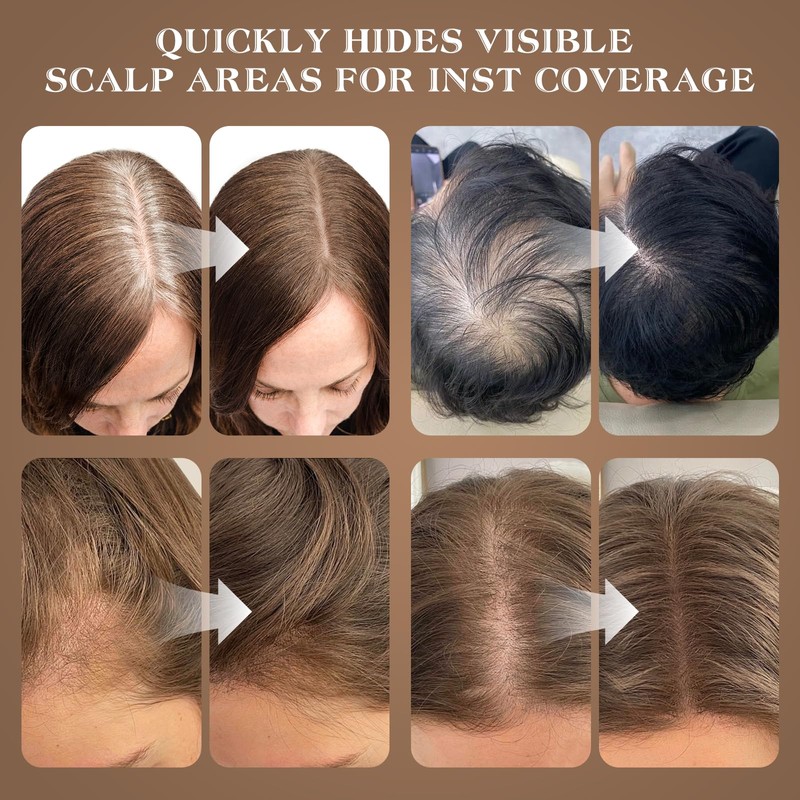 Yargkos Invisible Roots Powder, Instant Effect Hairline Powder, Women Waterproof