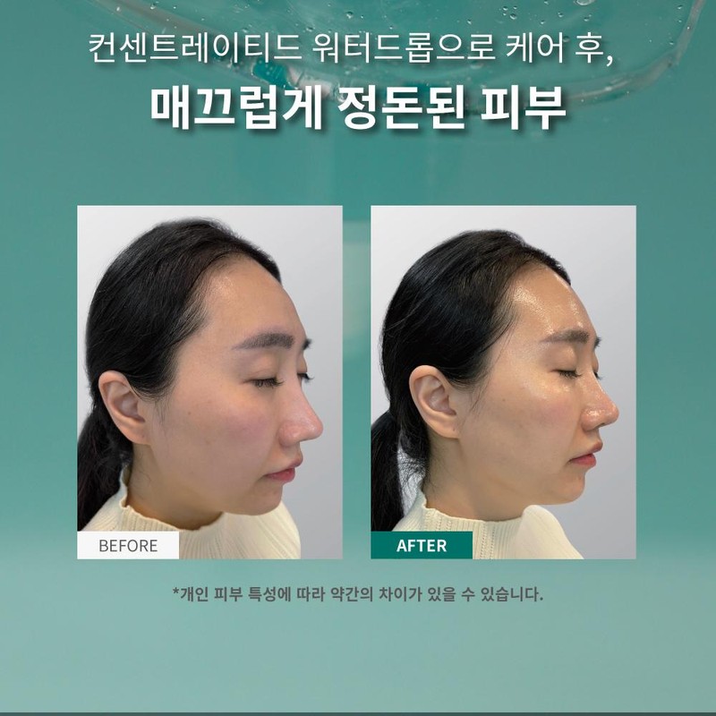 Partner company Eclat Dutin Water Drop Consentiladite Water Drop Ampoule