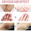 Dark Knuckle Whitening Serum, Whitening Serum Hand Knuckle Glow Serum
