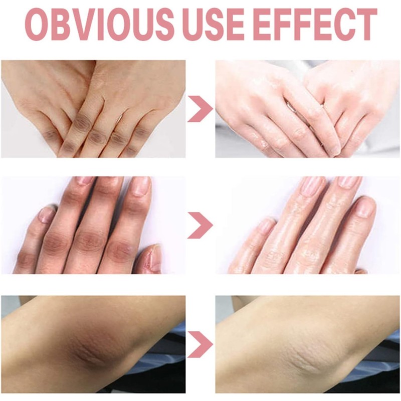Dark Knuckle Whitening Serum, Whitening Serum Hand Knuckle Glow Serum
