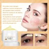 Crema para Venas Varicosas y Araas Vasculares, con Vitamina K,