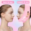 2PCS Mentonera Postquirúrgica Papada | Face Lift Tape Invisible |