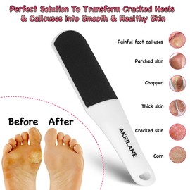 Pedicure Foot File | Double Sided Callus Remover | Foot Rasp Removes Dead Skin, Corn, Cracked Heels, Hard Skin for Wet and Dry Feet | Large Curved Foot File Scrubber | Foot Care Pedicure
