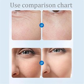 Turmskin Serum, Turmskin Hyaluronic Acid Serum, Hyaluronic Acid Tubes, 3 Hyaluronic Acid Serum Ultra-Hydrating Vials, Hyaluronic Acid Serum (1 Pcs)   