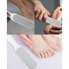 MYGLOAR 2 Pieces Callus Remover Callus Scraper Callus File Foot