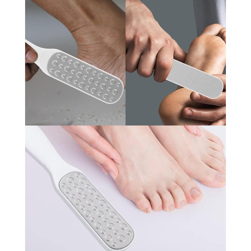 MYGLOAR 2 Pieces Callus Remover Callus Scraper Callus File Foot