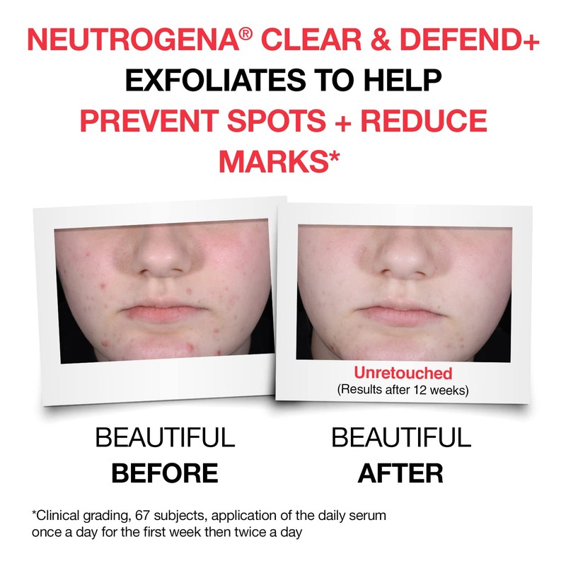 Neutrogena Clear and Defend+ Serum 30 ml