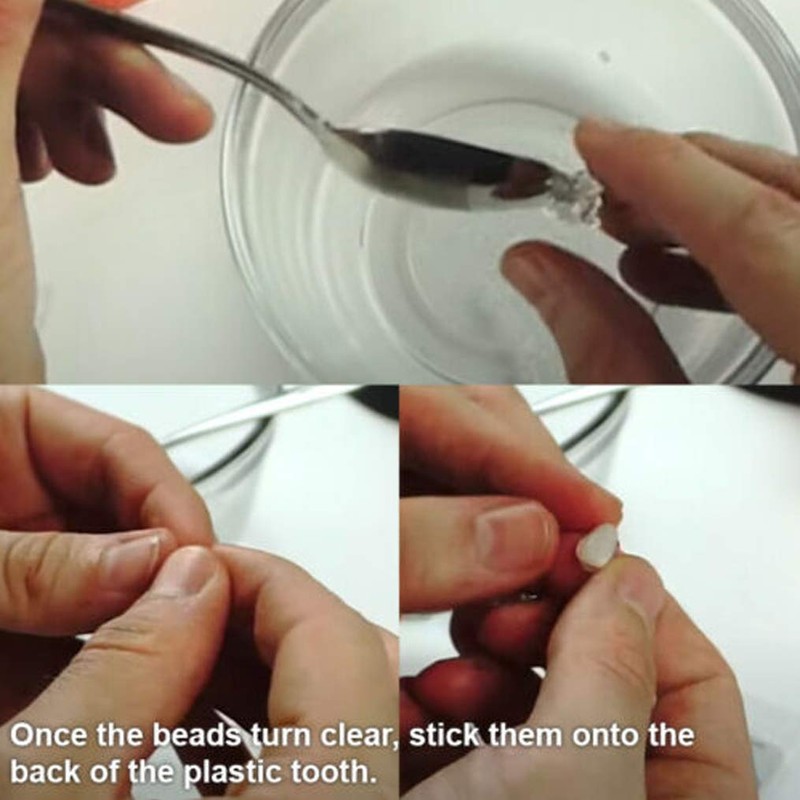 Instant Smile Select A Tooth Temporary Tooth Replacement Kit -