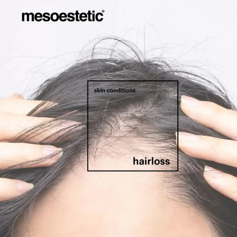 Mesoestetic Tricology Shampoo 225ml