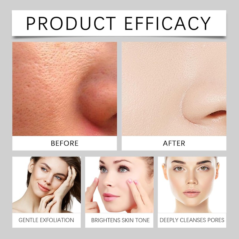 Ampolla Exfoliante De Arroz Blanco Y Negro Axnzp Limpieza Profunda