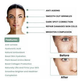 5 Piezas De Suero Facial Antiarrugas Collagen Boost Essence