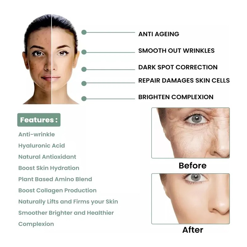 5 Piezas De Suero Facial Antiarrugas Collagen Boost Essence
