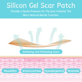 Volhuluk Transparentes Silikon Narbenpflaster(4x150cm), Silikonpflaster Professionell für Narben Durch C-Sektion, Operationen, Verbrennungen, Keloid, Akne und Mehr, Silikonpflaster für Narben